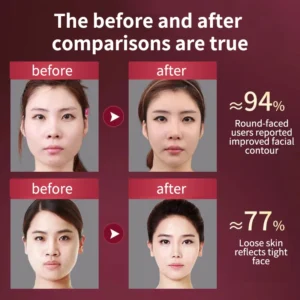 V-Face Massager for Facial Lifting, Tightening, and Sagging Prevention with 12 Adjustable